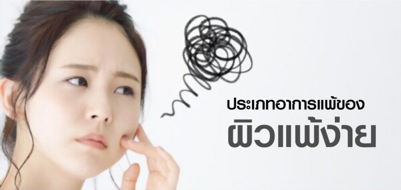 Sensitive Skin ประเภทผิวแพ้ง่าย ผิวบอบบาง