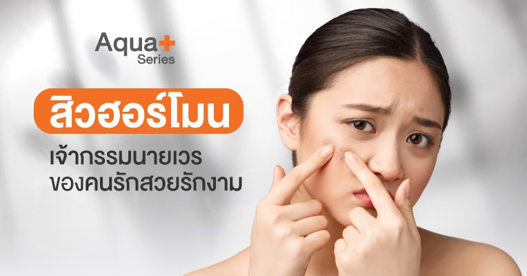 สิวฮอร์โมน